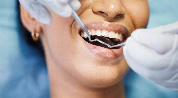 Best Knocked-Out Tooth Emergency  in St Georges, DE