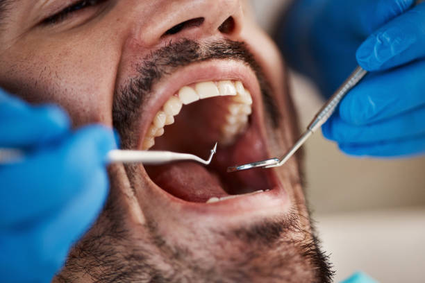 Best Broken Tooth Emergency  in St Georges, DE